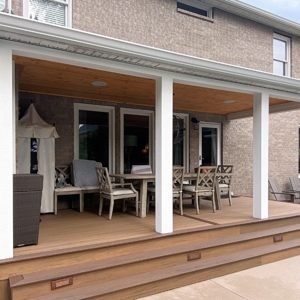 Streamlined Raleigh Covered Porch Addition With Square Columns